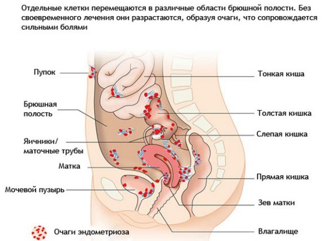 Дърпа болки в долната част на корема и гърдите - причини, възможни заболявания